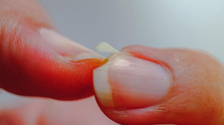 Meğer tırnak bu yüzden kırılıyormuş! Bu dertten sonsuza kadar kurtulmak mümkün!