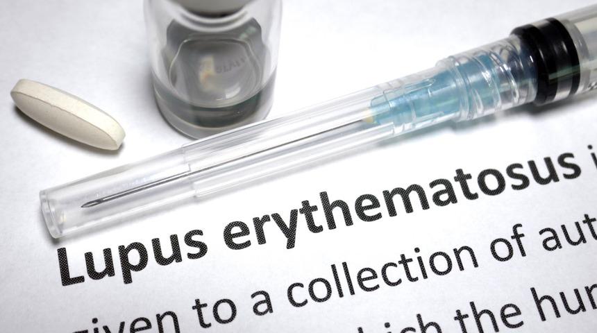 Lupus Hastalığı : Nedenleri, belirtileri, tedavisi