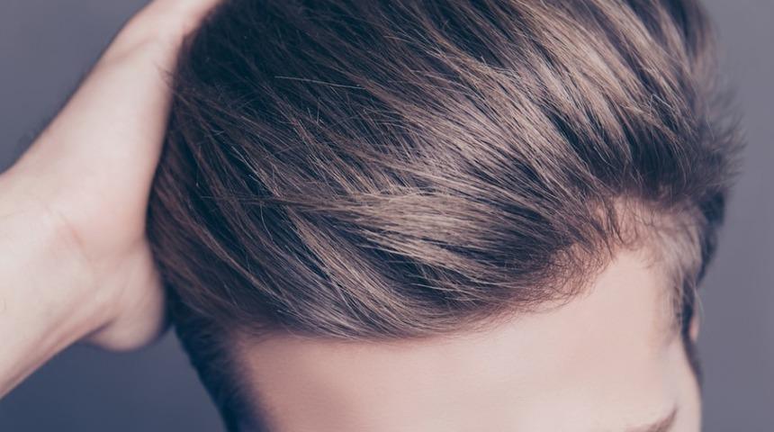 Sa&ccedil; ekimi fiyatlarını belirleyen fakt&ouml;rler