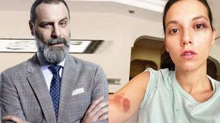 Ozan Güven’in dövdüğü Deniz Bulutsuz’un yeni fotoğrafları ortaya çıktı