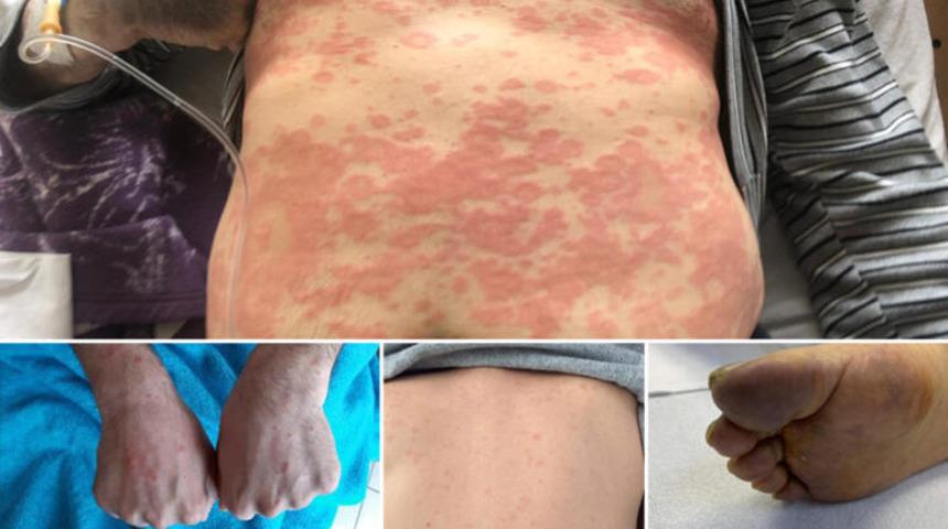 Cerrahpaşa'daki koronavir&uuml;s hastaları ilgili dikkat &ccedil;eken &ccedil;alışma!