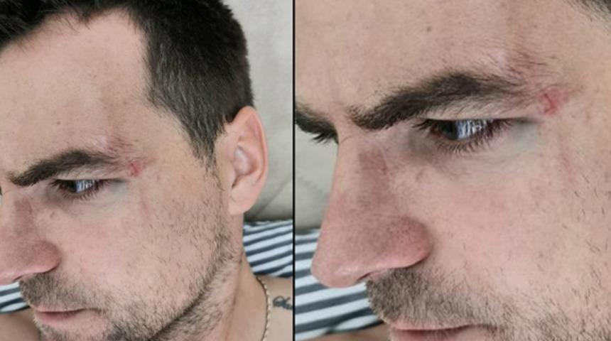 Ankaragücü'nde Gerson Rodrigues, Galatasaray maçı kadrosundan çıkarıldı