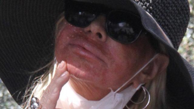 Pakize Suda lazer mağduru oldu