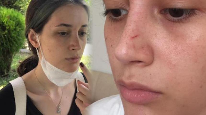 Üniversiteli Beril Nisa Aydın yaşadığı dehşet anlarını anlattı: Çığlık atarak kurtuldum