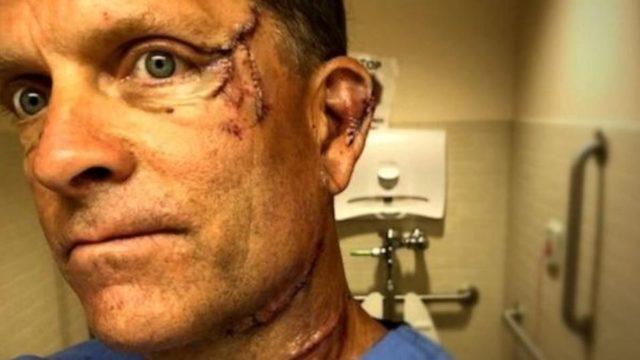 Ayının gazabından böyle kurtuldu