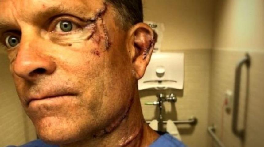 Ayının gazabından b&ouml;yle kurtuldu