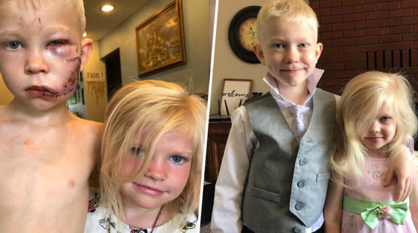 Kız kardeşini k&ouml;pek saldırısından kurtaran 6 yaşındaki kahraman