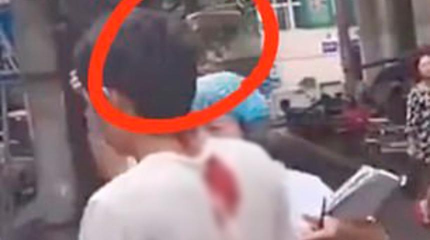 Çin'de kafasına saplı bıçakla hastaneye geldi