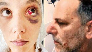 Ozan Güven’in şiddet uyguladığı Deniz Bulutsuz’un çıplak ayaklı kaçışının görüntüleri dosyada