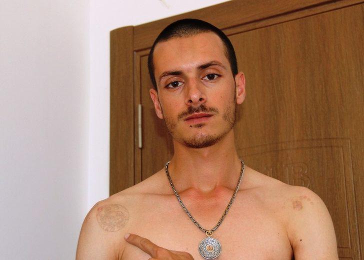 Dövmelerini sildirmek istedi! Hayatı kabusa dönüştü G3