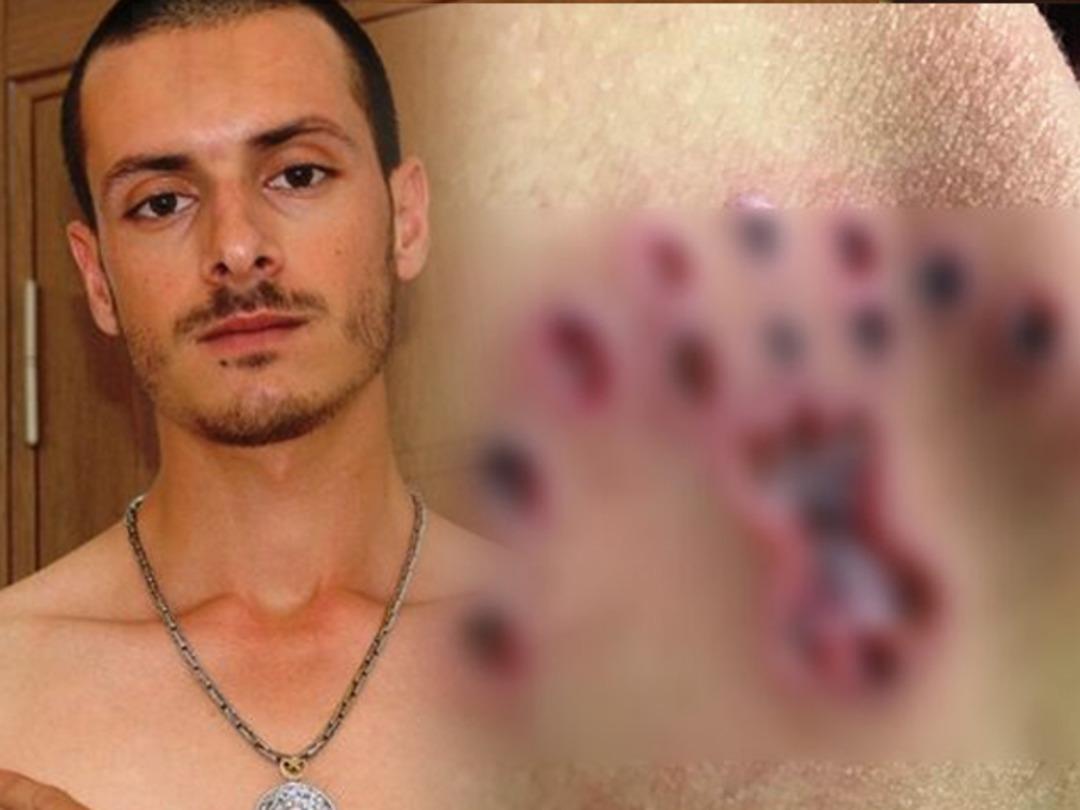 D&ouml;vmelerini sildirmek istedi! Hayatı kabusa d&ouml;n&uuml;şt&uuml;