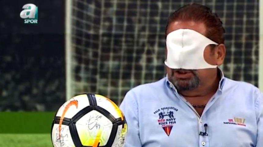 Erman Toroğlu, g&ouml;z&uuml;ne maske takarak yayına &ccedil;ıktı