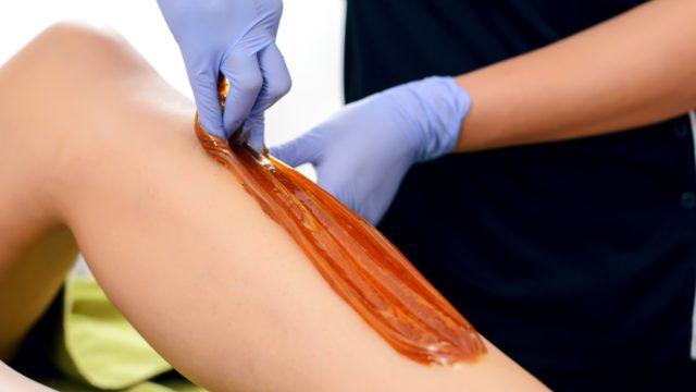 Ağda yanığından hangi yöntemlerle kurtulduğuna inanamayacaksınız! Meğer çok kolaymış...