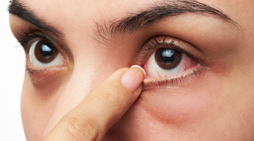 Üveit: Nedenleri, belirtileri, tedavisi