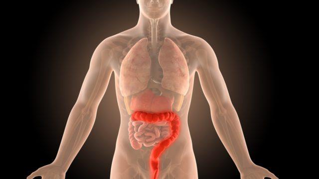 Ülseratif kolit: Nedenleri, belirtileri, tedavisi