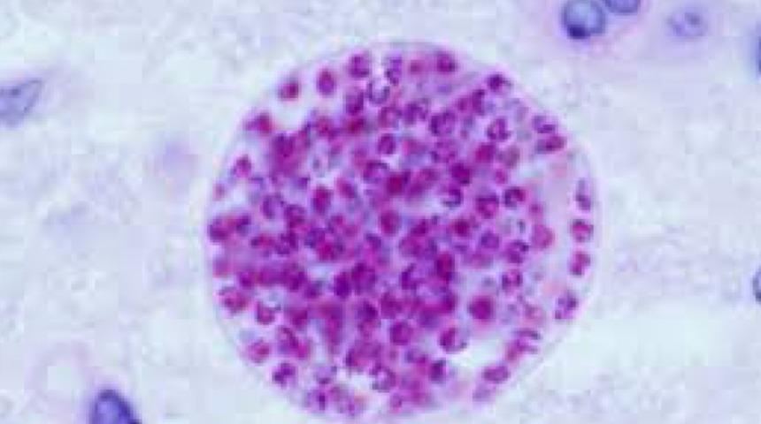 Bu parazit çok tehlikeli! Eğer beyne sızarsa durum ağırlaşır