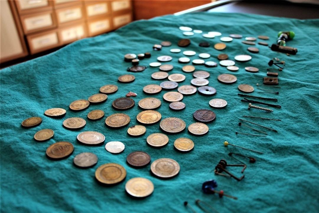 Hepsi &ccedil;ocukların midesinden &ccedil;ıktı! G&ouml;renleri şoke eden manzara