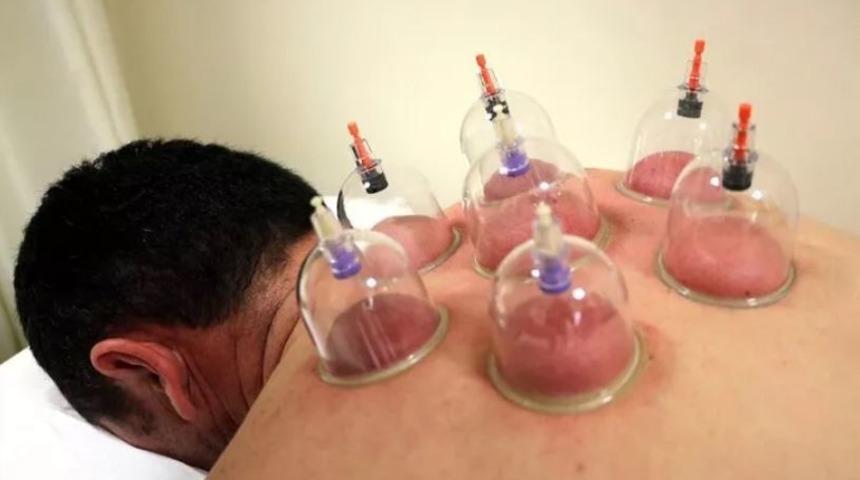 2020 Ağustos ayı hacamat takvimi - Ağustos ayında hangi g&uuml;nler hacamat yapılır?