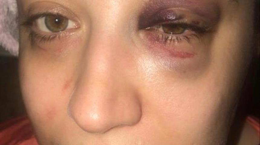 Bakırk&ouml;y'de eski eş dehşeti! 'Korkudan 1 aydır evden &ccedil;ıkamıyorum'