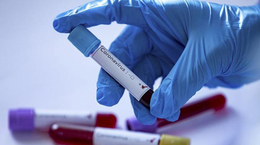 St. Mirren'de 7 kişide koronavirüs tespit edildi