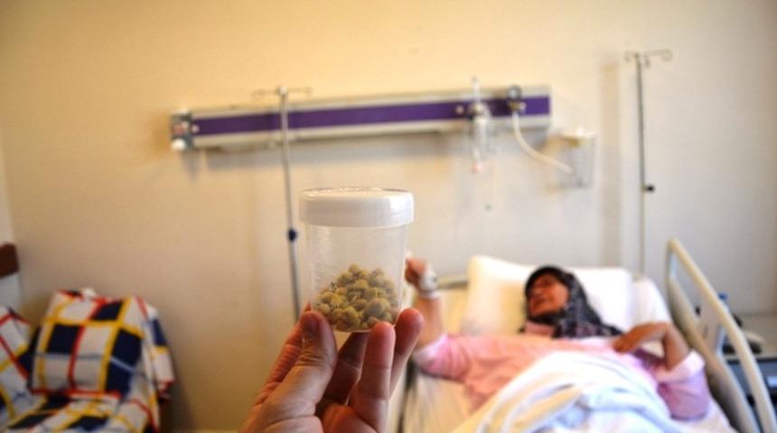 Safra kesesinden 80 taş çıktı