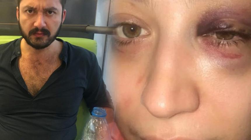 Gen&ccedil; kadın dehşeti yaşamıştı! Beylikd&uuml;z&uuml;'nde yakalandı