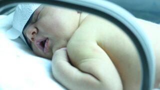 Sarılık : Nedenleri, belirtileri, tedavisi