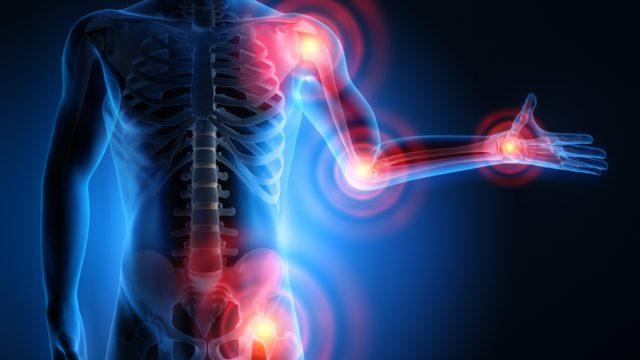 Romatizma : Nedenleri, belirtileri,tedavisi