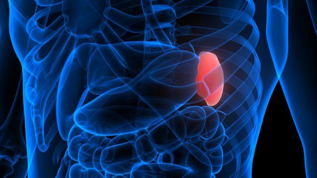 Dalak büyümesi: Nedenleri, belirtileri, tedavisi