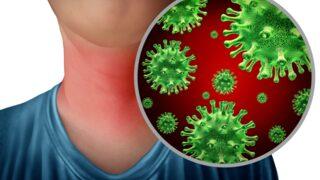 Bademcik Şişmesi : Neden olur, nasıl geçer?