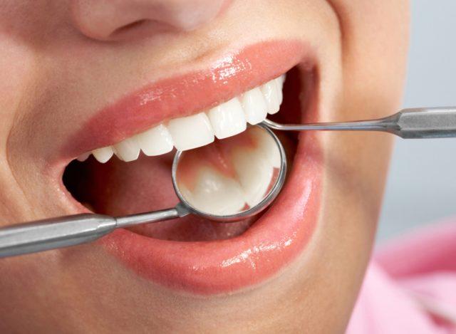 Diş eti ağrısı Neden olur, nasıl geçer? Sağlık Haberleri