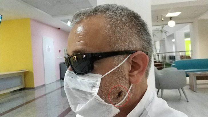 Samsun'da zabıta silahı ağzına sokup tetiğe bastı! İşte o anlar G2