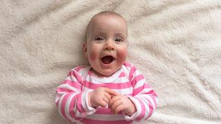 Koronavirüs tedavisinde kullanılan ilaç 'kelebek hastası' çocuklarda da kullanılıyor