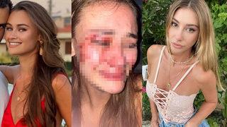 Şeyma Subaşı'nın model arkadaşı Daria Kyryliuk güvenlik görevlilerinin saldırısına uğradı