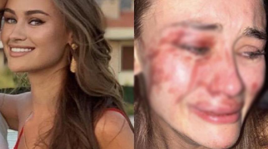 Dünyaca ünlü model Daria Kyryliuk darp edildiğini iddia etmişti! Yeni gelişme