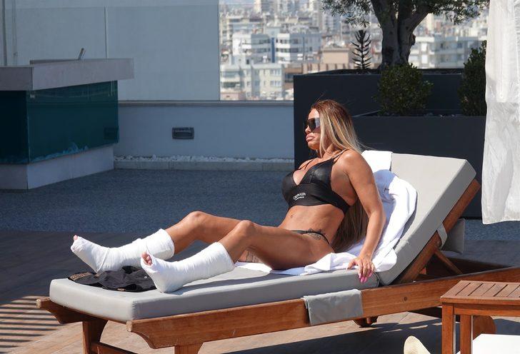 Katie Price tatilde kaza geçirdi G5