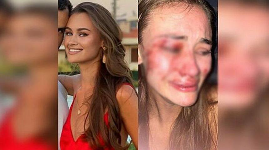 Son dakika: Ala&ccedil;atı&rsquo;da 6 eğlence kul&uuml;b&uuml; ve mekan kapatıldı!