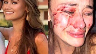 Daria Kyryliuk'a saldırıda çifte şüphe! Polisler sevgilisini teşhis etti