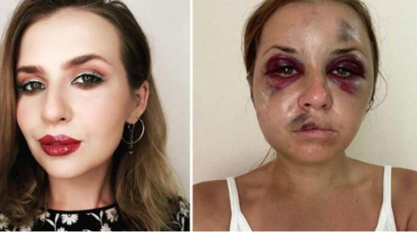 Televizyon sunucusuna trende tecav&uuml;z dehşeti 