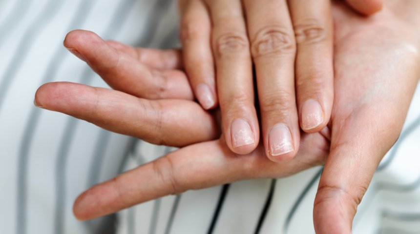 Uyurken eller ve parmaklar neden uyuşur, normal midir?