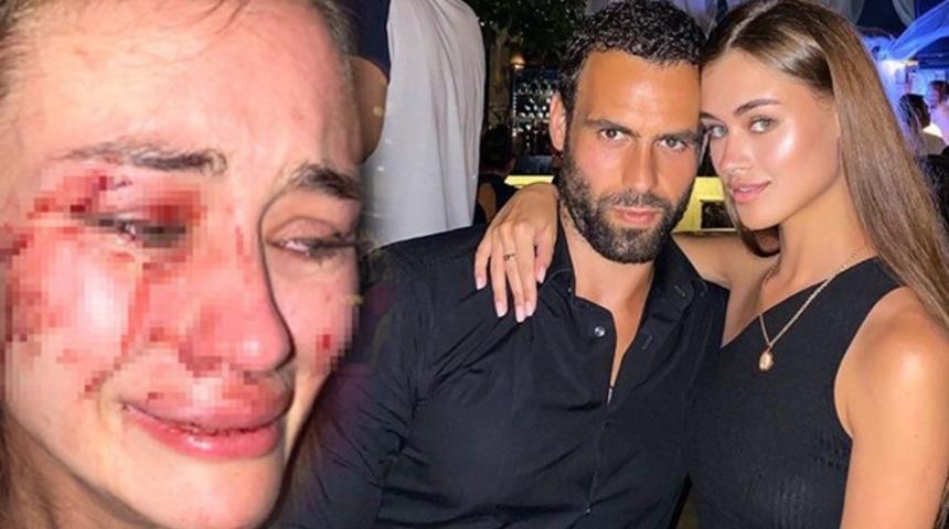 Ukraynalı kadına darpla ilgili son dakika haberi! Çeşme Kaymakamı görevden alındı