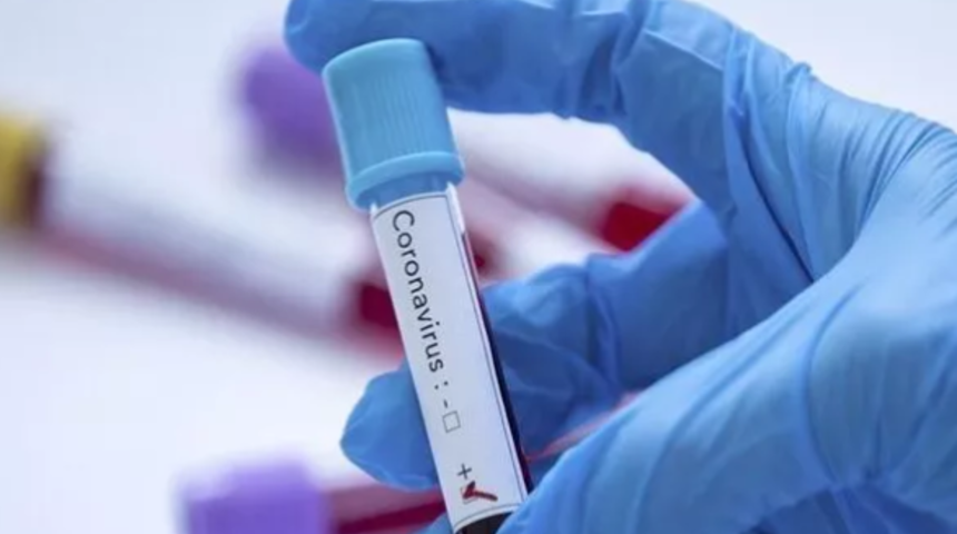 İstanbul'da evde koronavirüs testi dönemi!