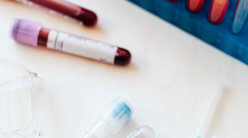 Kimse önemsemiyor ama bu belirtiler demir eksikliğine işaret edebilir! Uzmanlar uyardı...