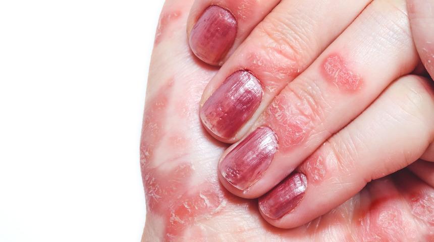 Cildiniz koronavirüs kurbanı olmasın! İşte cildi stresten koruma yolları