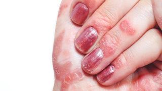 Cildiniz koronavirüs kurbanı olmasın! İşte cildi stresten koruma yolları