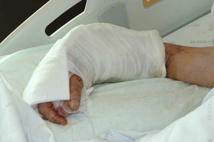 İş kazasında kopmuştu! Fabrika işçisinin kolu 12.5 saatte yerine dikildi G2