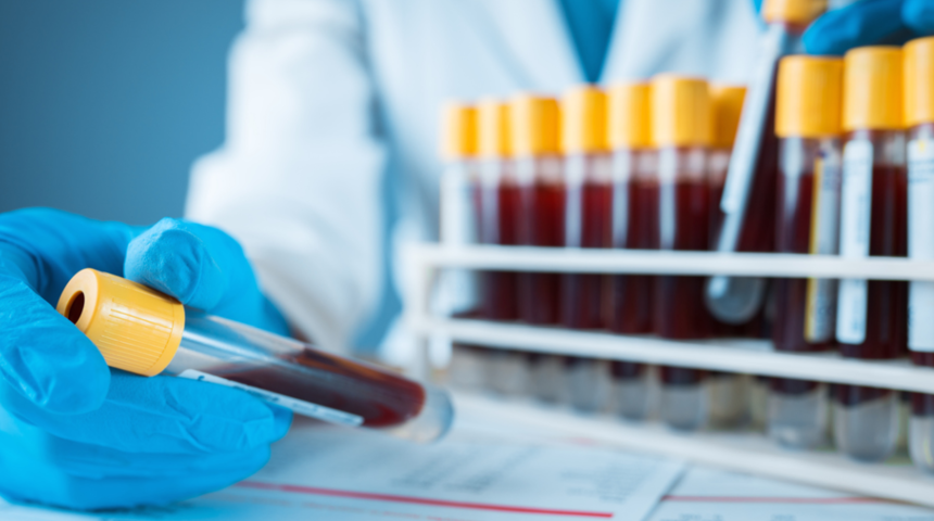 Adet d&ouml;neminde kan alınır mı, kan verilir mi, tahlil yapılır mı?