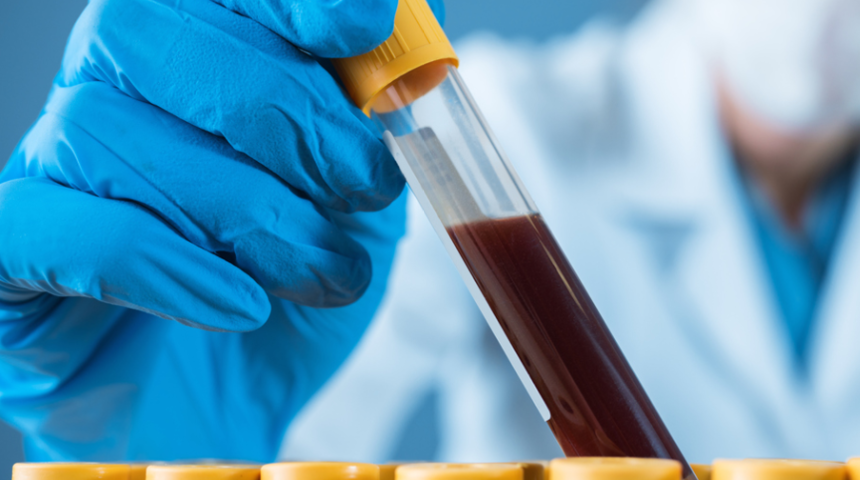 Neu (N&ouml;trofil) nedir, neu d&uuml;ş&uuml;kl&uuml;ğ&uuml;, y&uuml;ksekliği, normal değeri