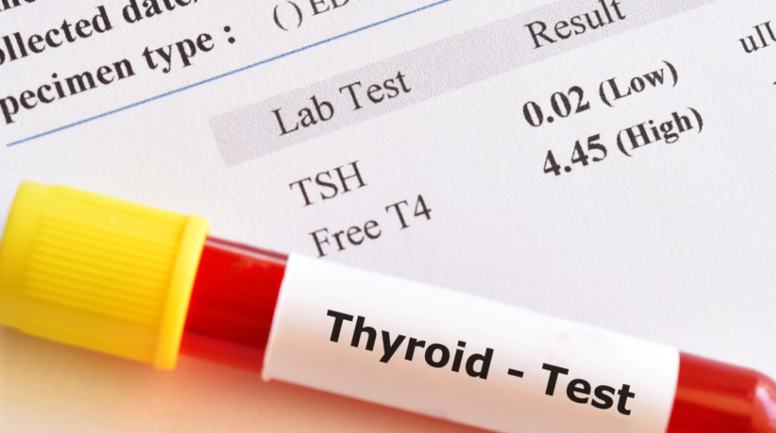 TSH nedir, TSH d&uuml;ş&uuml;kl&uuml;ğ&uuml;, y&uuml;ksekliği, normal değeri