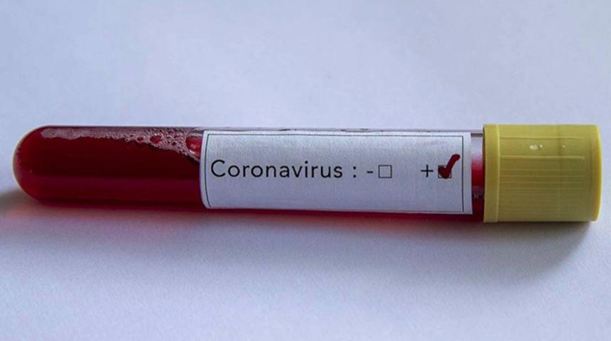 MotoGP'de bir kişide koronavirüs tespit edildi